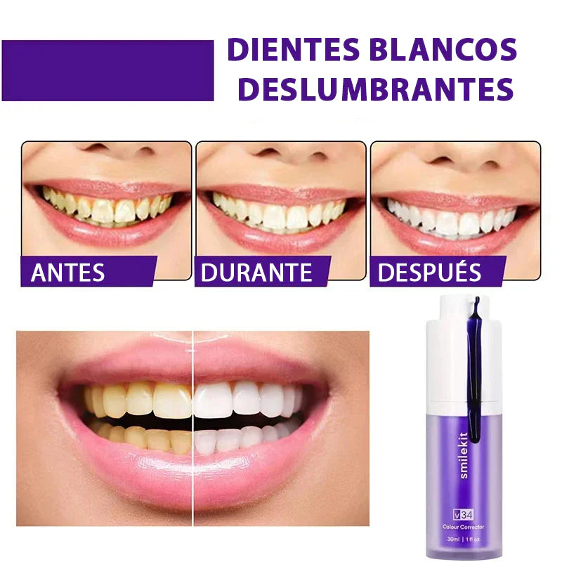 ¡SMILEKIT® BLANQUEADOR DENTAL!