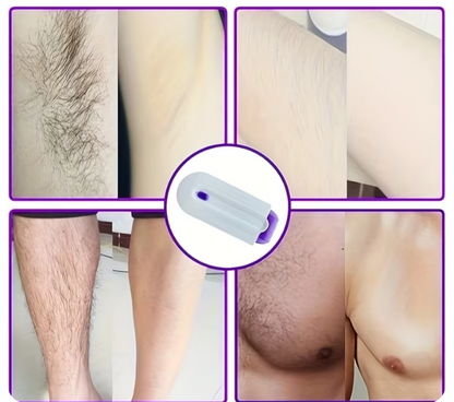 ¡2x1 DEPILADORA CORPORAL ELÉCTRICA UNISEX!