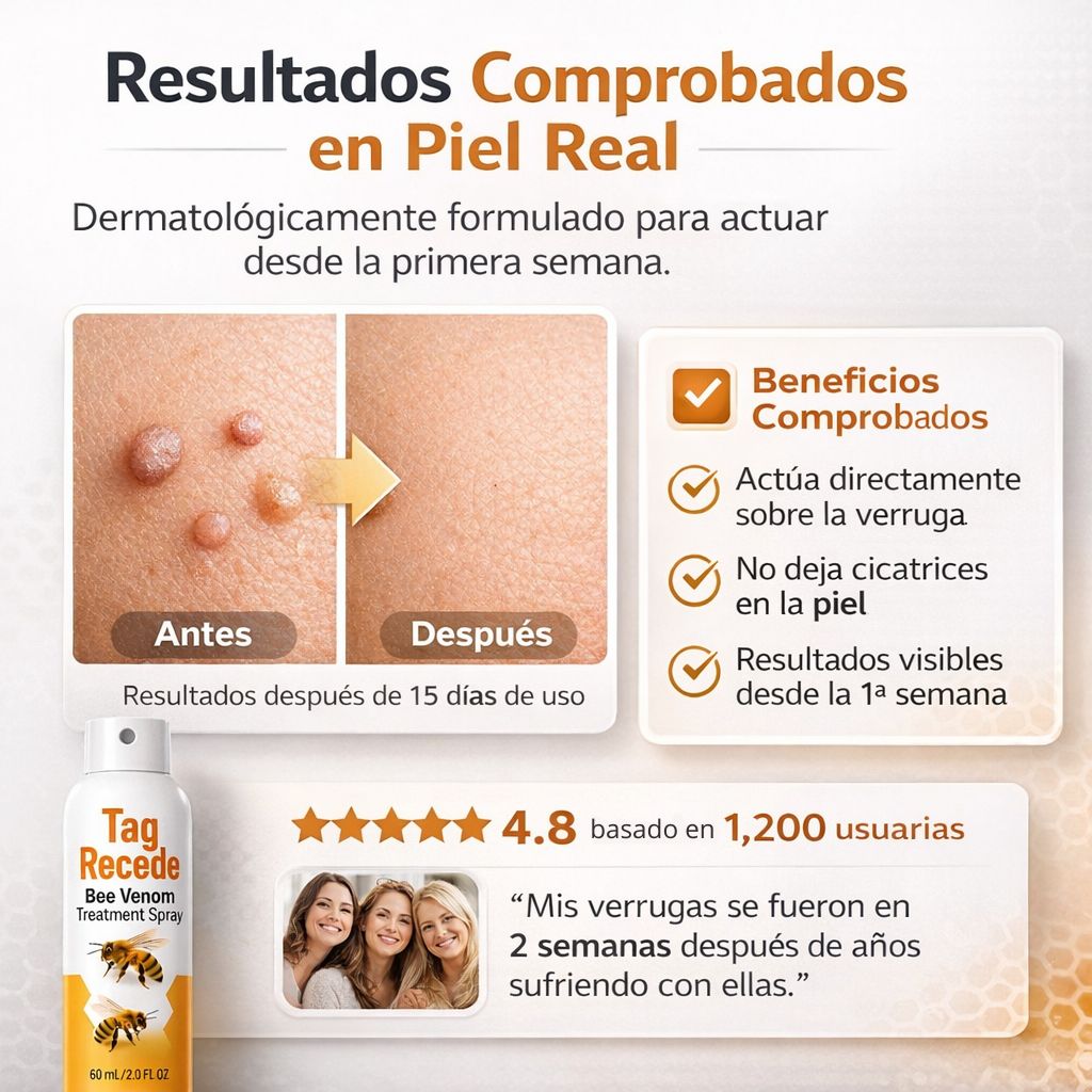 Spray eliminador de verrugas Tag Recede | 60 ML