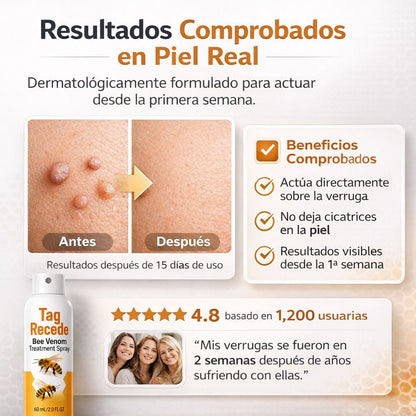 Spray eliminador de verrugas Tag Recede | 60 ML