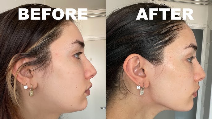 ¡MASAJEADOR FACIAL REDUCTOR DE PAPADA!